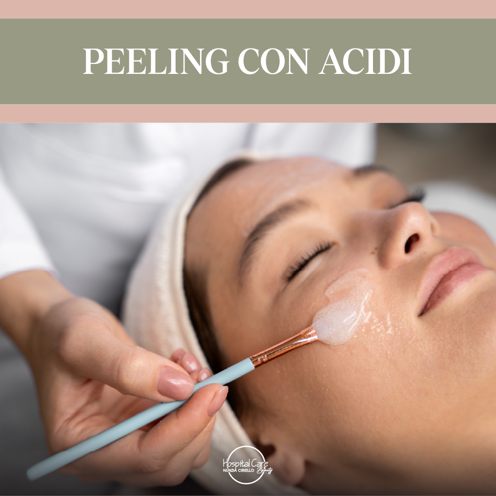 Peeling con Acidi Personalizzato