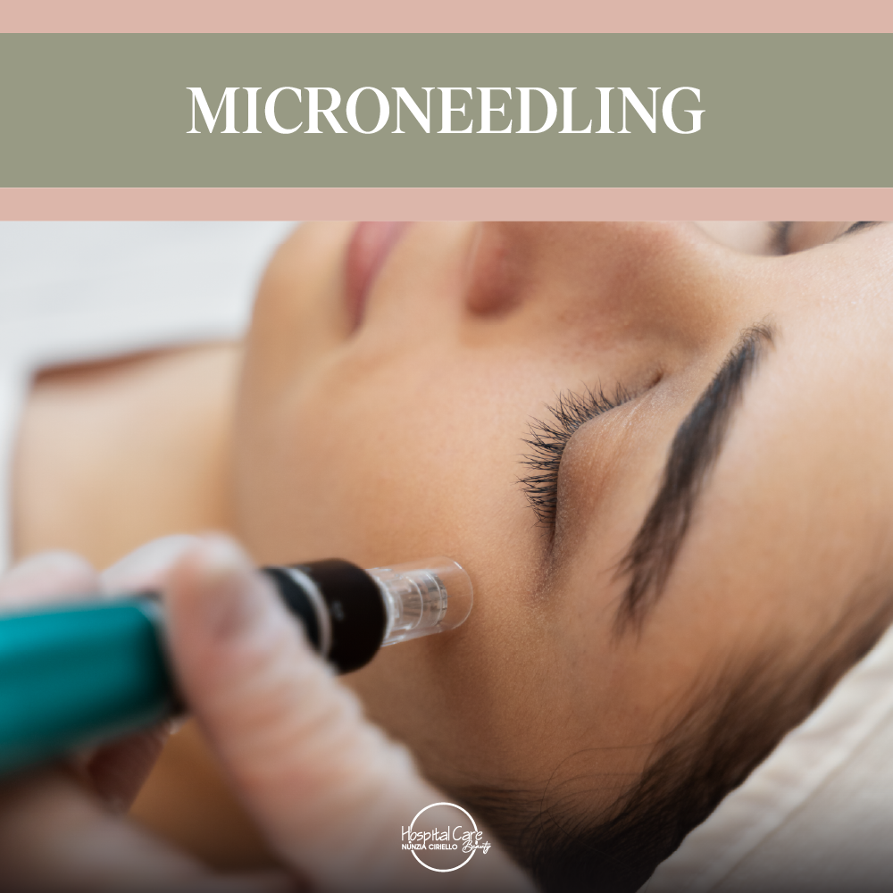 Trattamento di Microneedling